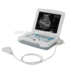 ноутбук диагностическая машина &amp; портативный мобильный ультразвуковой оборудование для беременности ДГ-500
